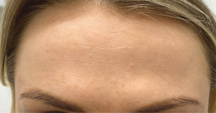 After - Lighthouse Dental