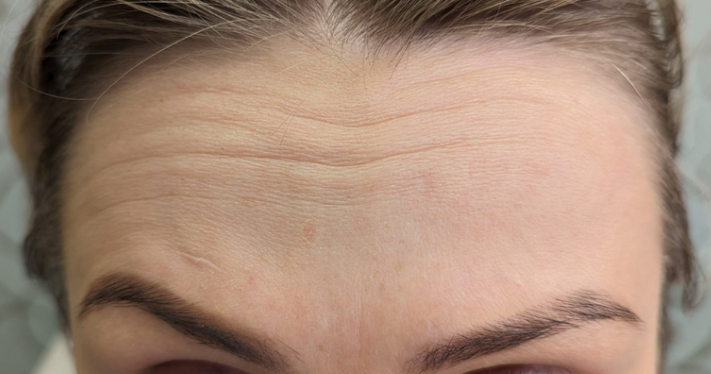 Before - Lighthouse Dental