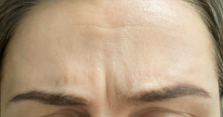 After - Lighthouse Dental