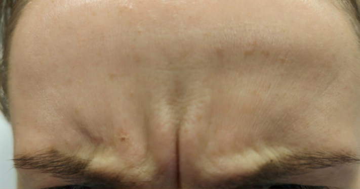 Before - Lighthouse Dental