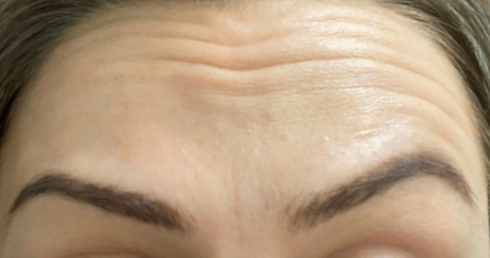 After - Lighthouse Dental