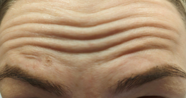 Before - Lighthouse Dental