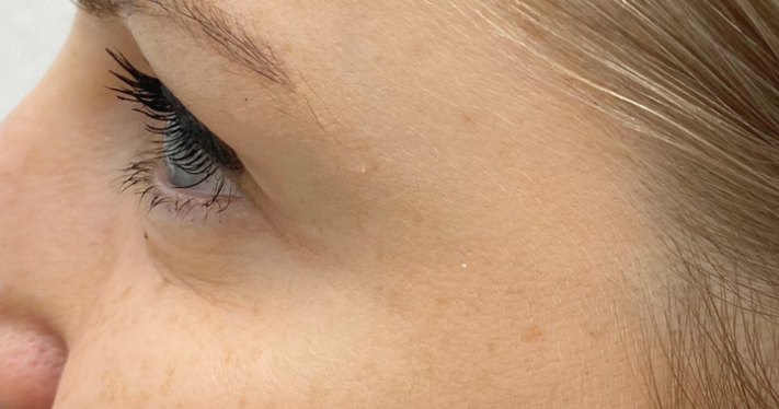 After - Lighthouse Dental