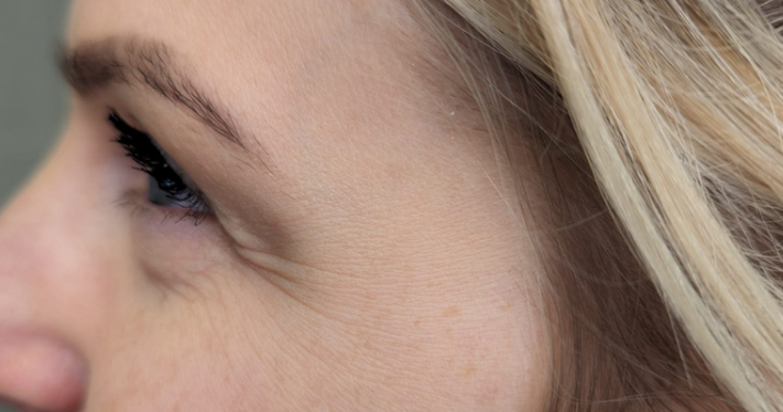 Before - Lighthouse Dental