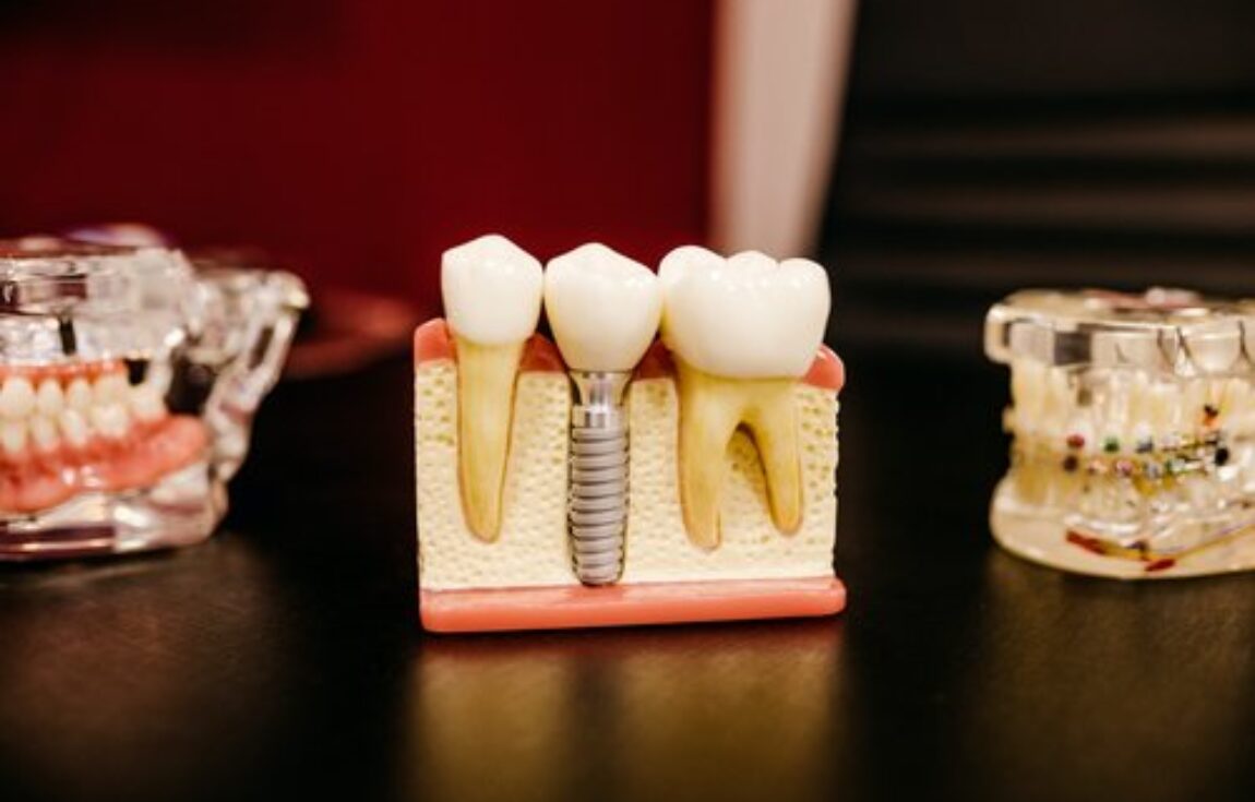 blog - Lighthouse Dental