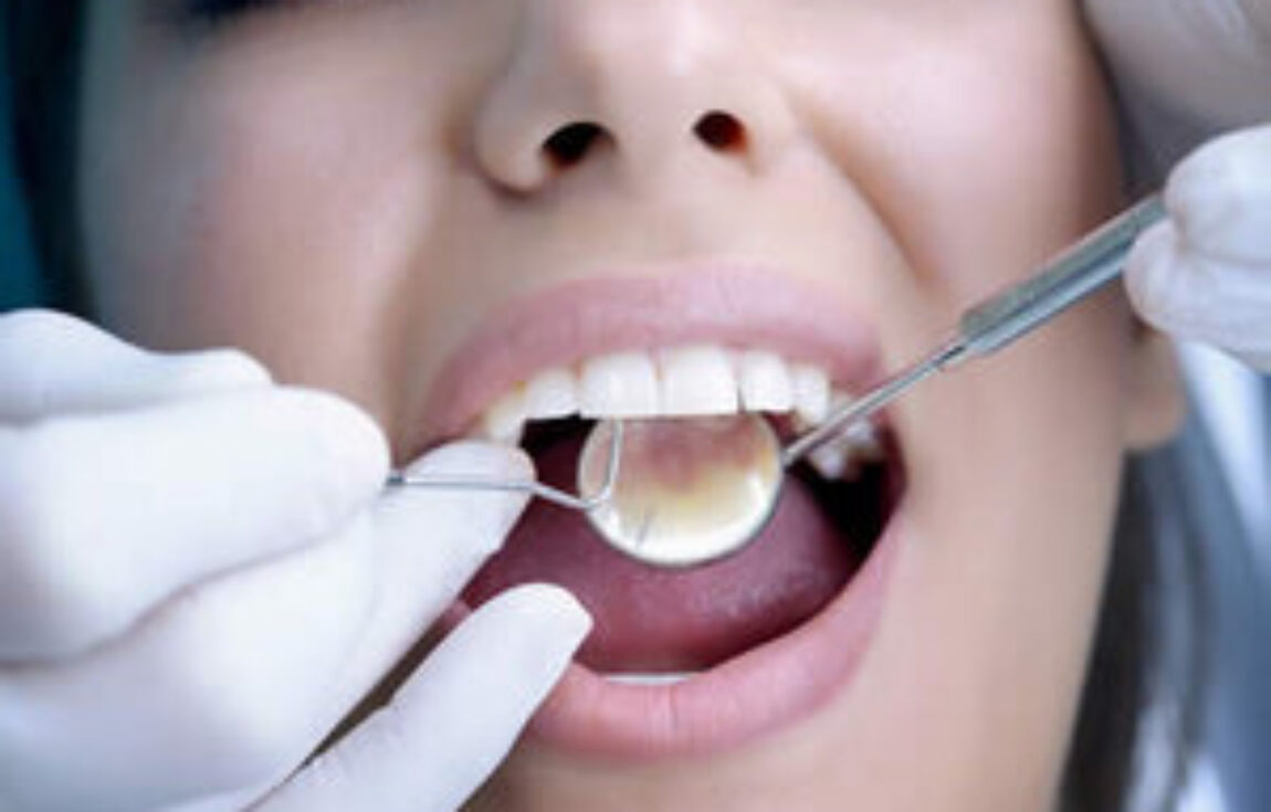 blog - Lighthouse Dental