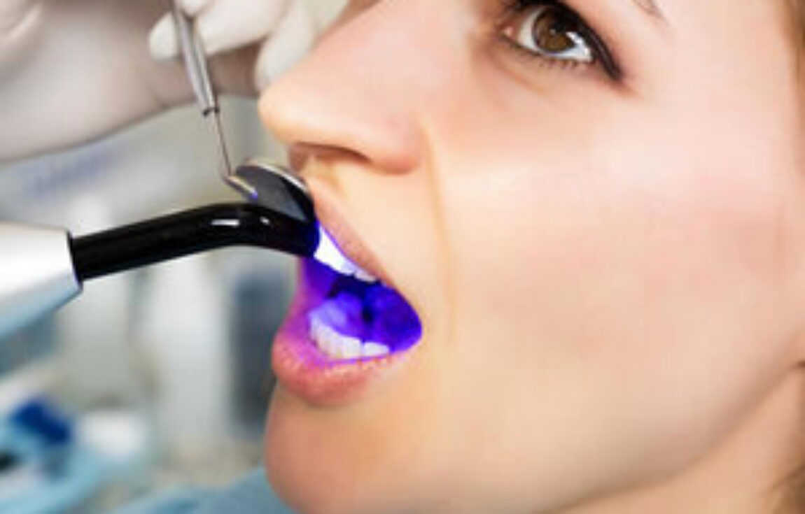 blog - Lighthouse Dental