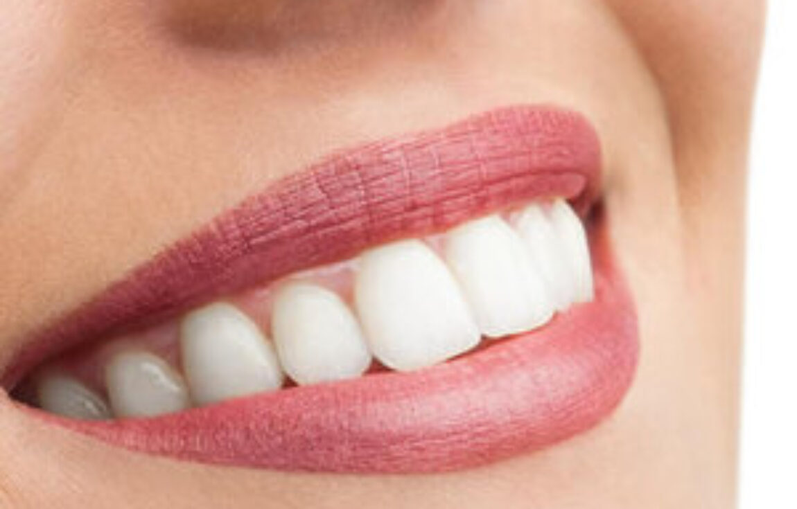 blog - Lighthouse Dental