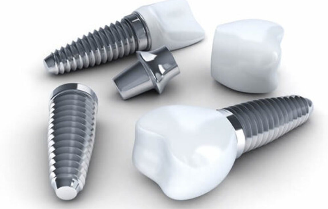 blog - Lighthouse Dental