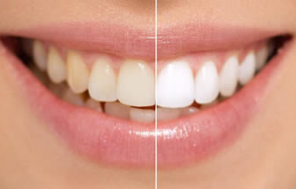 blog - Lighthouse Dental