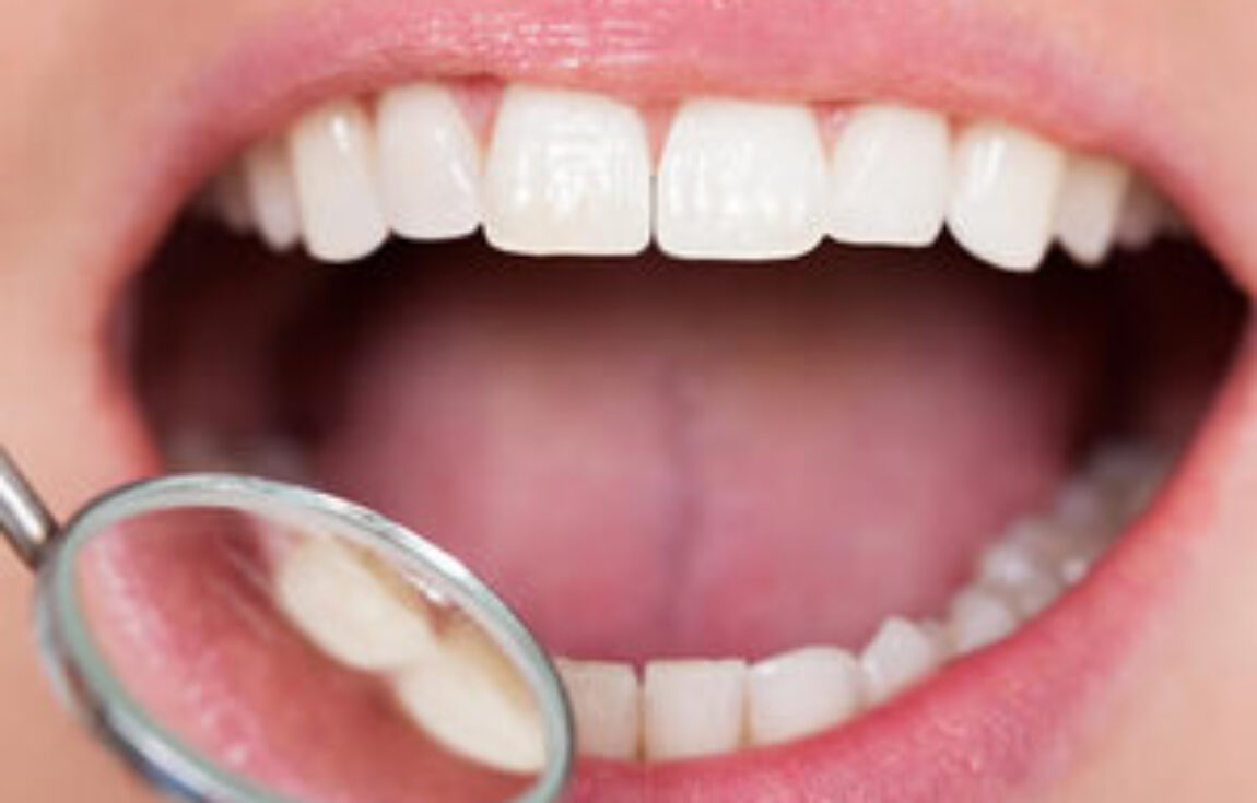 blog - Lighthouse Dental