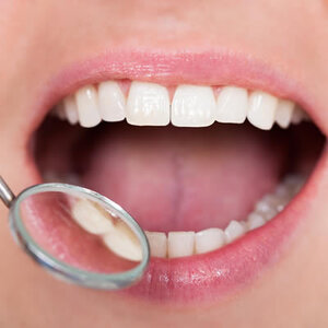 blog inner thumb : Lighthouse Dental