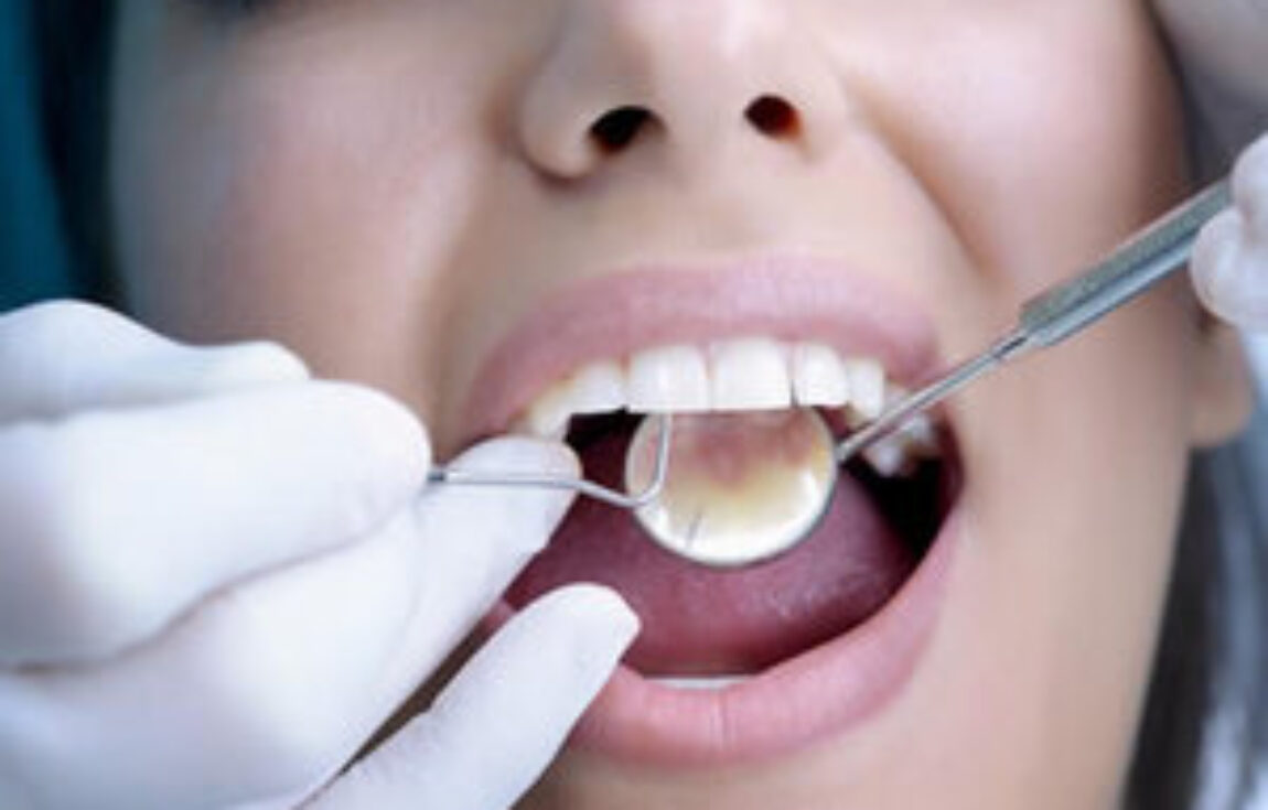 blog - Lighthouse Dental