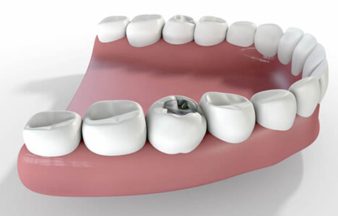 blog - Lighthouse Dental