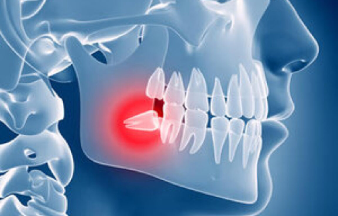 blog - Lighthouse Dental