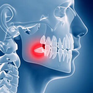 blog inner thumb : Lighthouse Dental