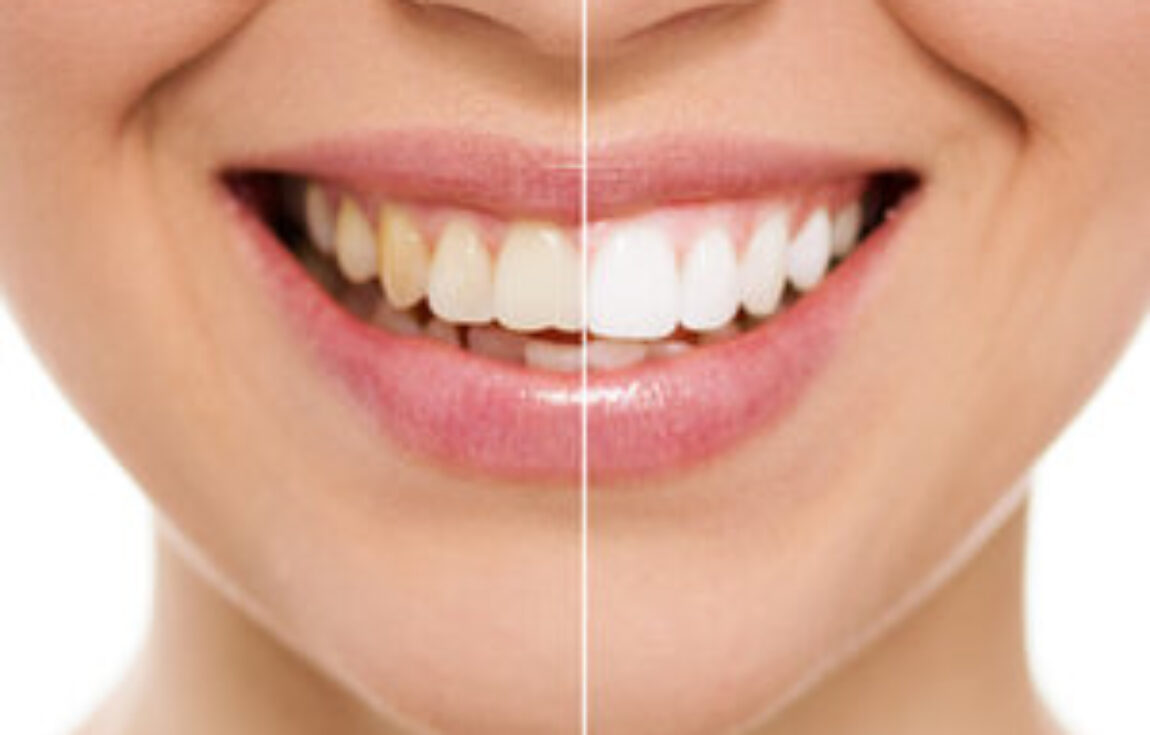 blog - Lighthouse Dental