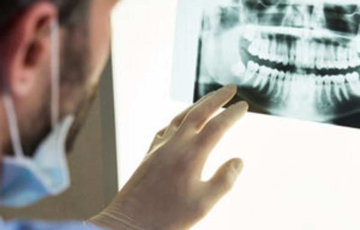 blog - Lighthouse Dental