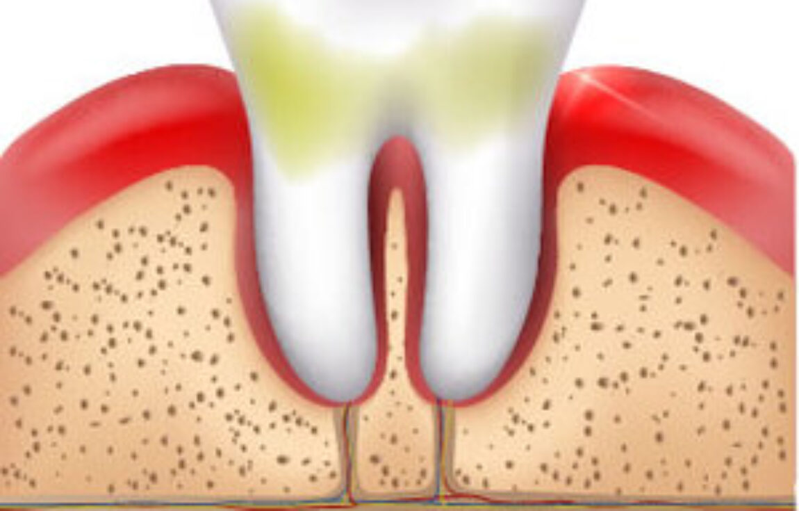 blog - Lighthouse Dental