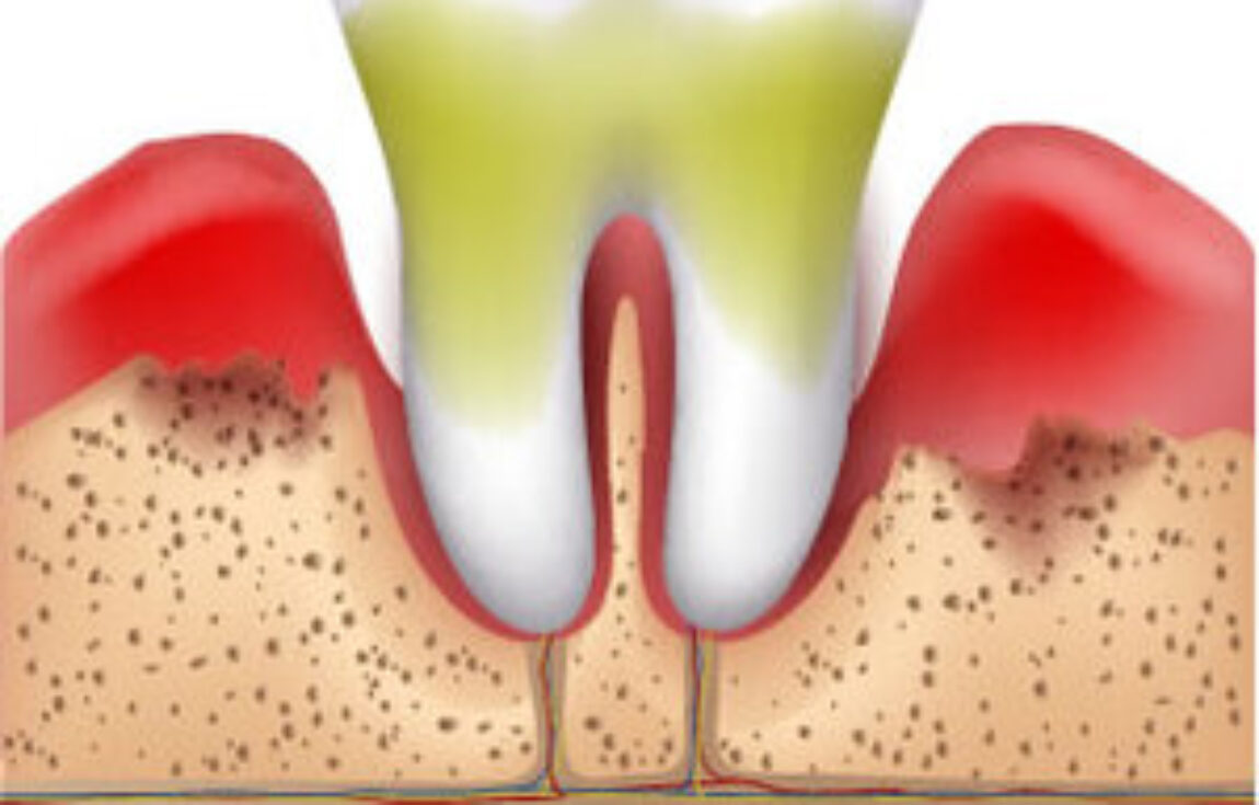 blog - Lighthouse Dental