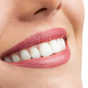 blog inner thumb : Lighthouse Dental