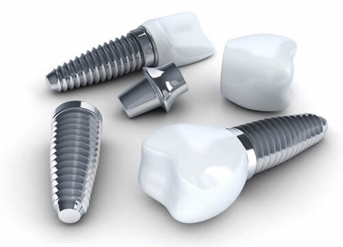 blog inner thumb : Lighthouse Dental