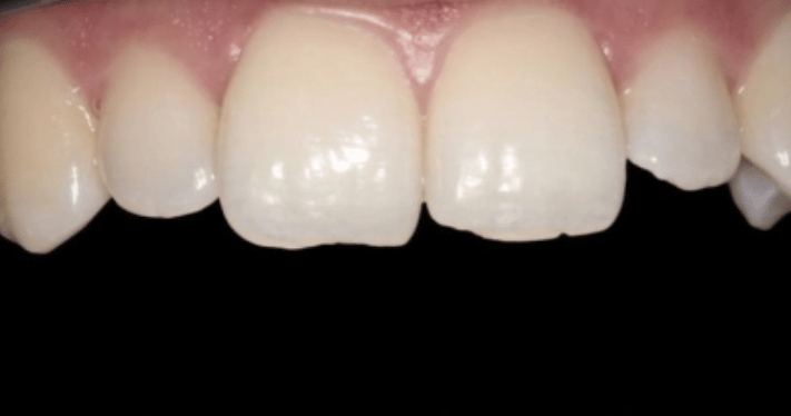 Before - Lighthouse Dental