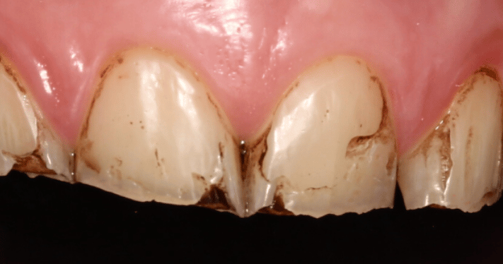 Before - Lighthouse Dental