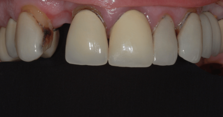 Before - Lighthouse Dental