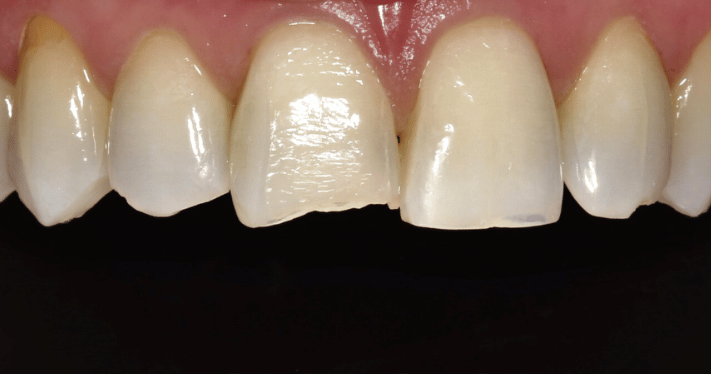 Before - Lighthouse Dental