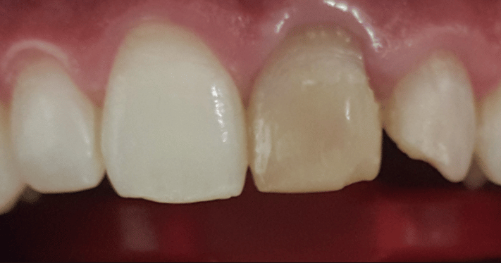 Before - Lighthouse Dental