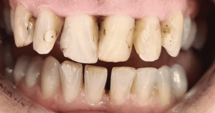 Before - Lighthouse Dental