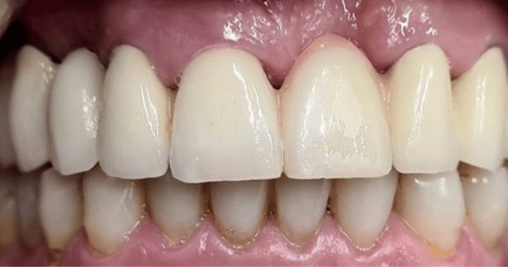 After - Lighthouse Dental