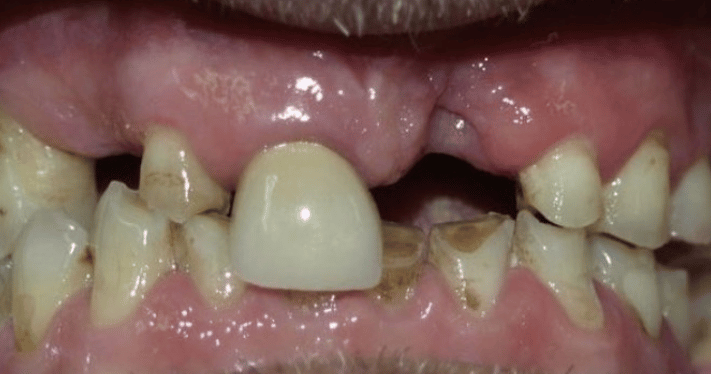 Before - Lighthouse Dental