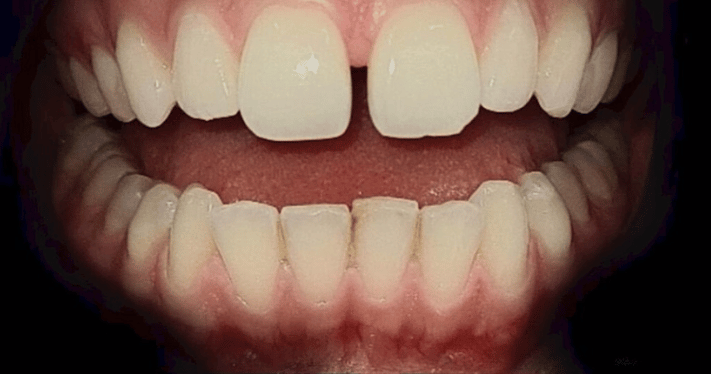 Before - Lighthouse Dental