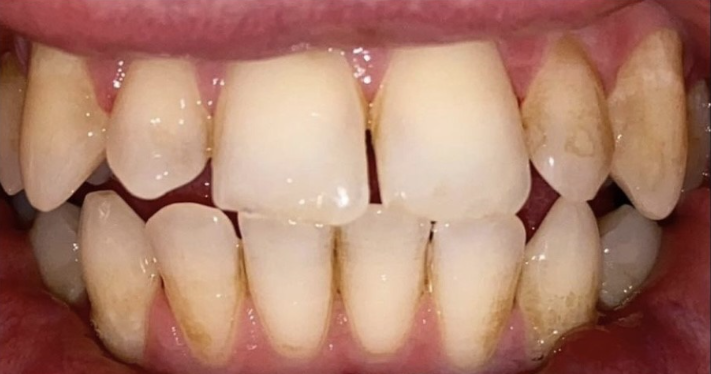 Before - Lighthouse Dental