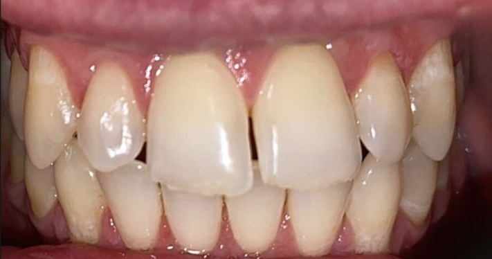 After - Lighthouse Dental