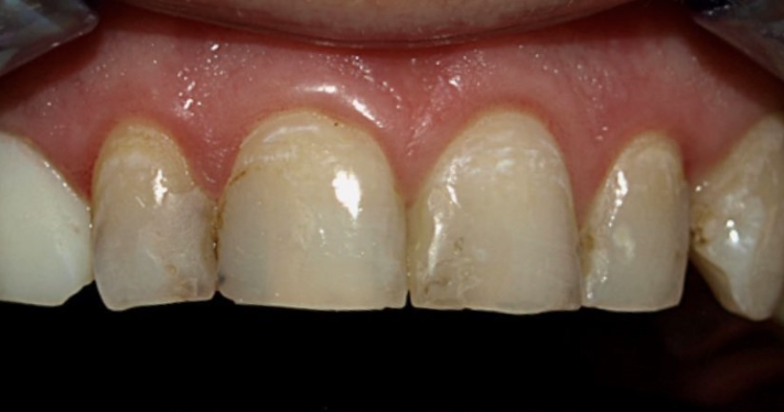 Before - Lighthouse Dental